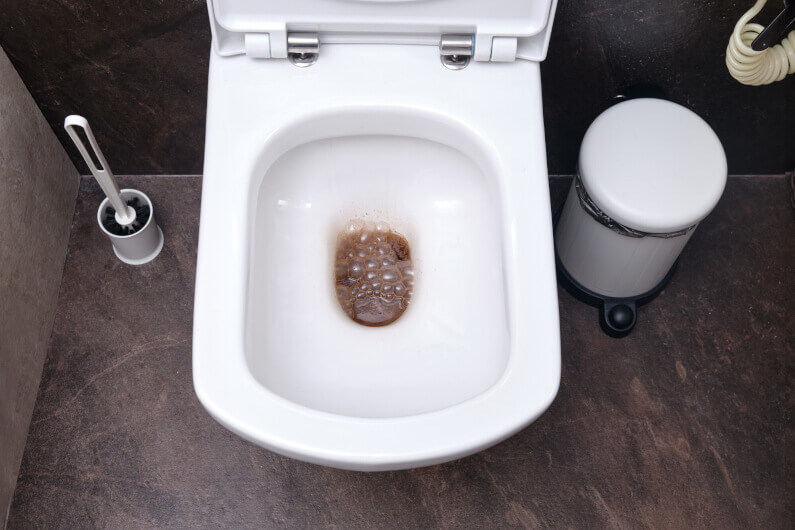 4 Reasons You May Have a Recurring Toilet Clog